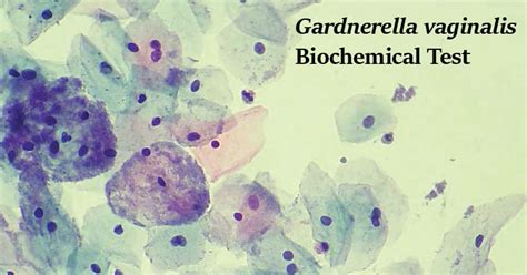 Biochemical Test Of Gardnerella Vaginalis Biochemical Test Of 32574