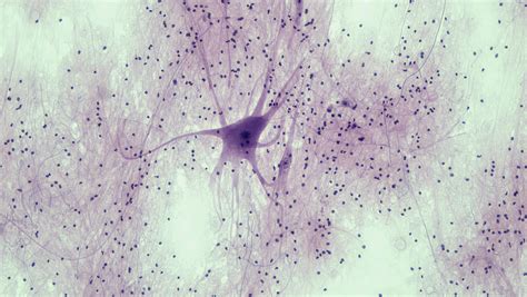 Microscope Nervous Tissue Micropedia