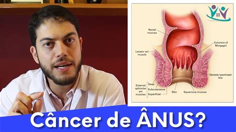 O Que Voc Sabe Sobre O C Ncer De Nus Dr Marcelo Werneck Youtube