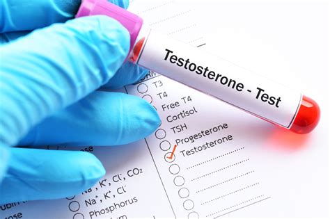 Testosterone Loss In Aging Men May Increase Risk Of Cognitive Decline Dementia