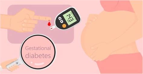 Gestational Diabetes Diet Plan Sugarfit