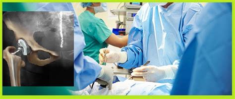 Hip Replacement Surgery World Best Orthopedic Surgeons In India Hip Replacement Surgery Hip