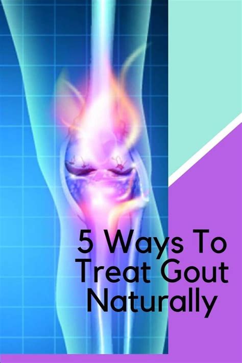 5 Ways To Treat Gout Naturally Gout How To Cure Gout Gout Relief