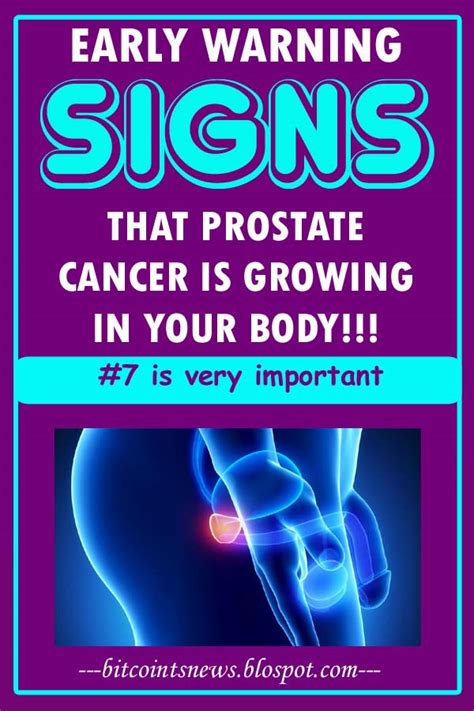However, urologists recommend men to watch out for some signs which may indicate the presence of an early stage prostate cancer. 12 Early Warning Signs Of Prostate Cancer That Every Guy ...