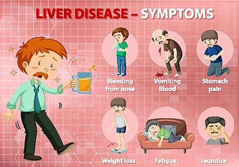 Cartoon Infographic Depicting Symptoms Of Liver Disease Drawing Cartoon