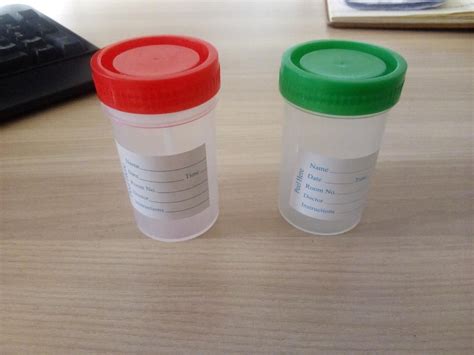 Urine And Stool Containers Mes Kenya