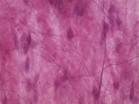 Loose Fiborous Connective Tissue Areolar Bio B Flickr