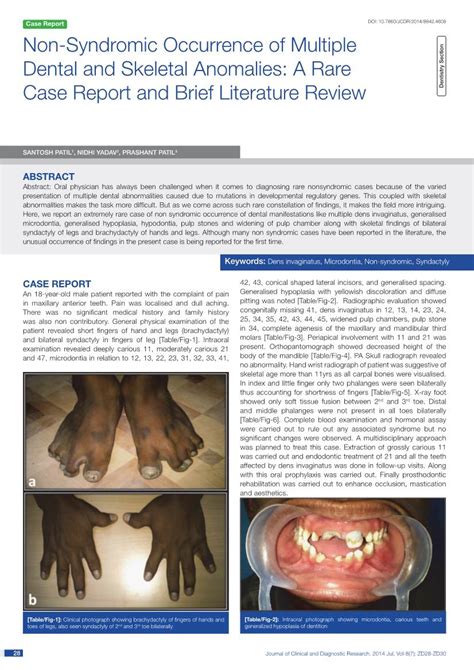 Non Syndromic Occurrence Of Multiple Dental And Skeletal Anomalies A