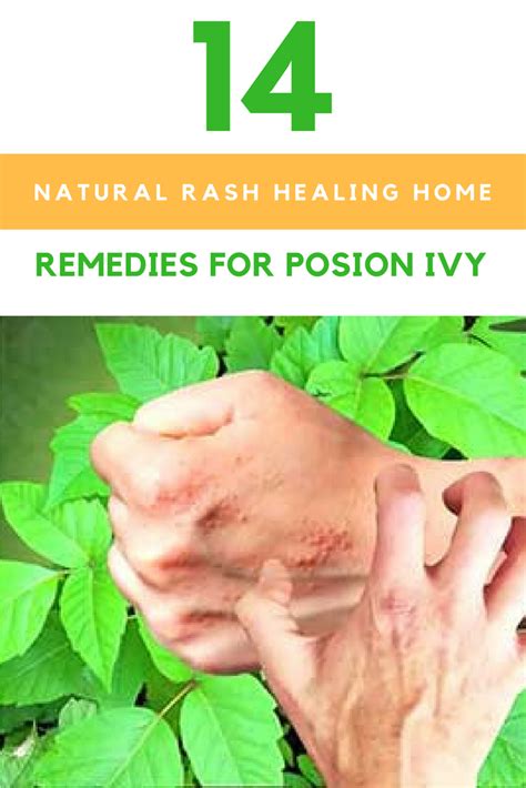 14 Natural Rash Healing Home Remedies For Poison Ivy Poison Ivy