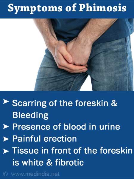 Phimosis Patient Handout