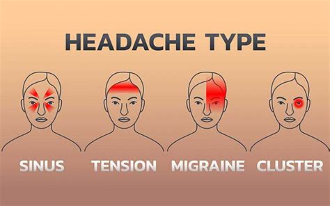 Headaches Explained Relief Types And Causes