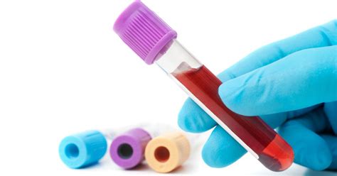 New Blood Tests Help Detect 8 Types Of Cancer Early