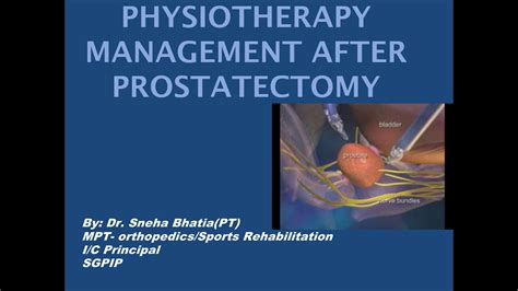 Physiotherapy Management After Prostatectomy Youtube
