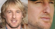What happened to Owen Wilson's nose? History of the Nose by Owen Wilson ...