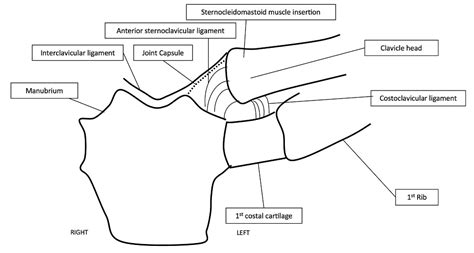 Clavicle Fractures Allman And Neer Classification Journal Of