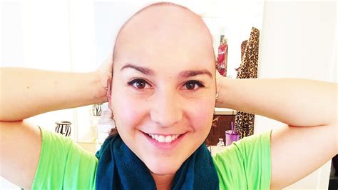 Rachel Going Bald Youtube