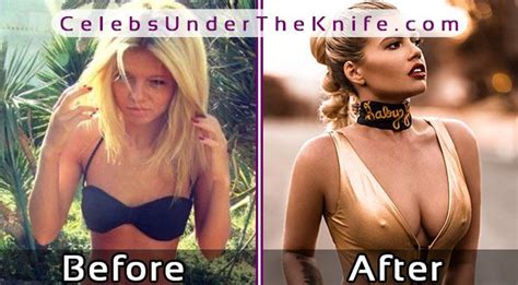 Chanel West Coast Plastic Surgery Before And After Photos The Best