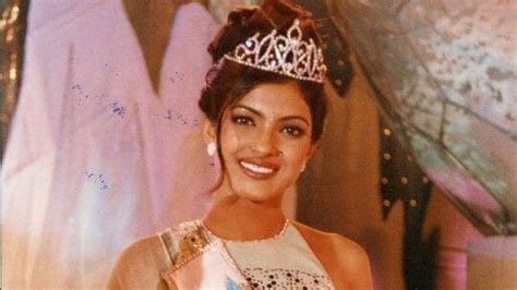 Did You Know That Priyanka Chopra Burnt Herself Before Being Crowned