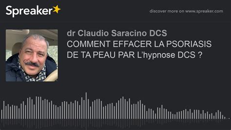 COMMENT EFFACER LA PSORIASIS DE TA PEAU Par Lhypnose DCS YouTube