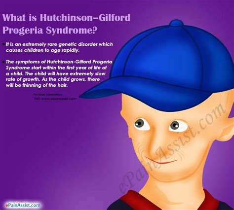Progeria Definition Types Symptoms Facts Britannica
