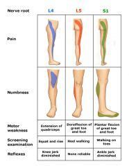 The prevalence of the injury is about 1 to 3%. L4, L5, S1 - Google 搜尋 | Massage therapy, Medical knowledge, Body anatomy