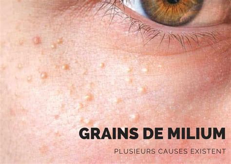 Grains De Milium Tout Savoir