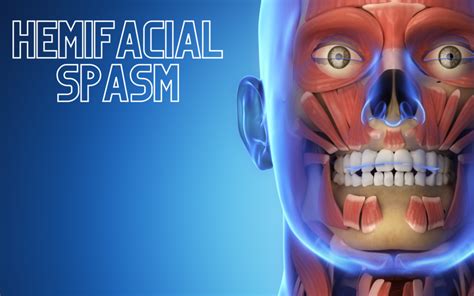 Demystifying Hemifacial Spasm Causes Symptoms And Treatment Options