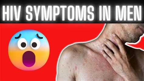 Early Signs And Symptoms Of Hiv In Males Youtube