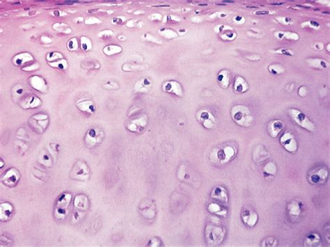 Different Types Of Histology Cells Flashcards Flashcards By Proprofs