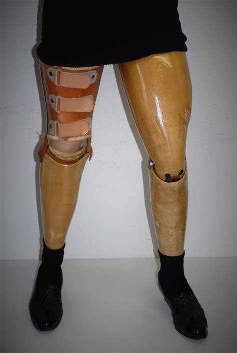 Bilateral Amputee With Wooden Legs Prosthetic Leg Amputee Model Legs