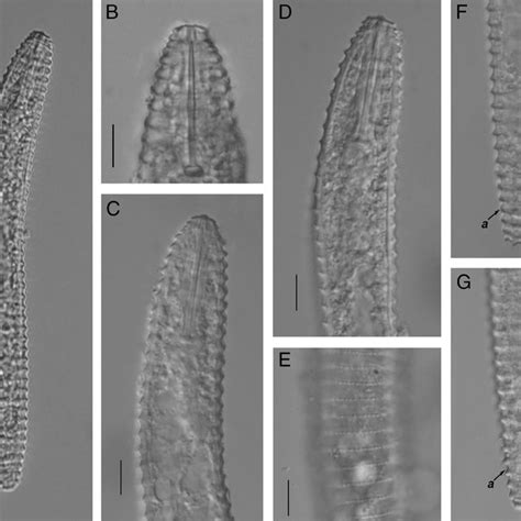 Light Photomicrographs Of Nothocriconemoides Hangzhouensis N Sp