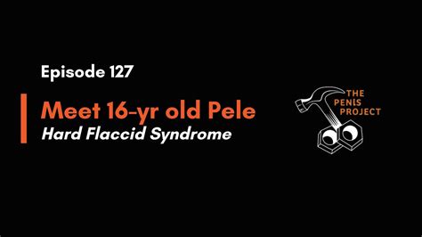 Pele A Year Old BRAVE Babe Man Hard Flaccid Syndrome YouTube