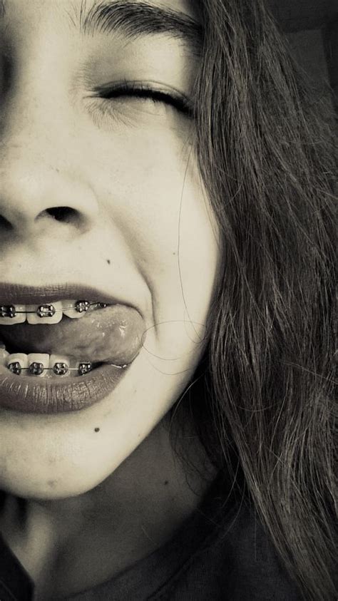selfies exclusivas para chicas con brackets fotos de brackets dientes con brackets brackets