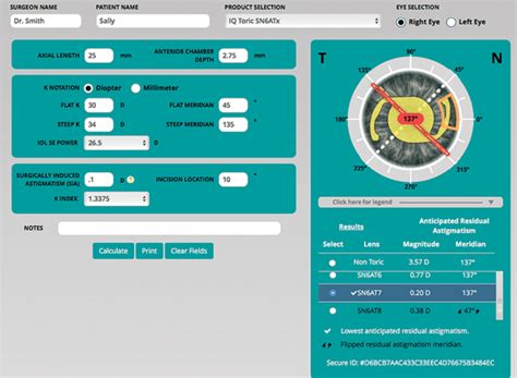 Online Alcon Toricol Calculator Barrett Holladay I Formula Iols Directory