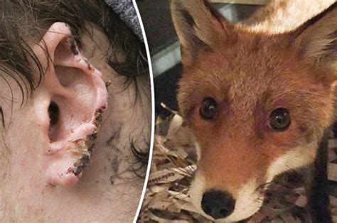 Fox Bites Off Mans Ear As He Sleeps On Park Bench Daily Star