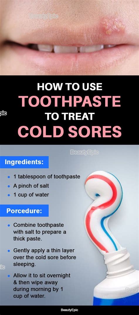 Increased mucus in the mouth. How To Use Toothpaste To Treat Cold Sores | Cold sore ...