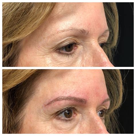 Image Result For Microblading Before And After Older Women