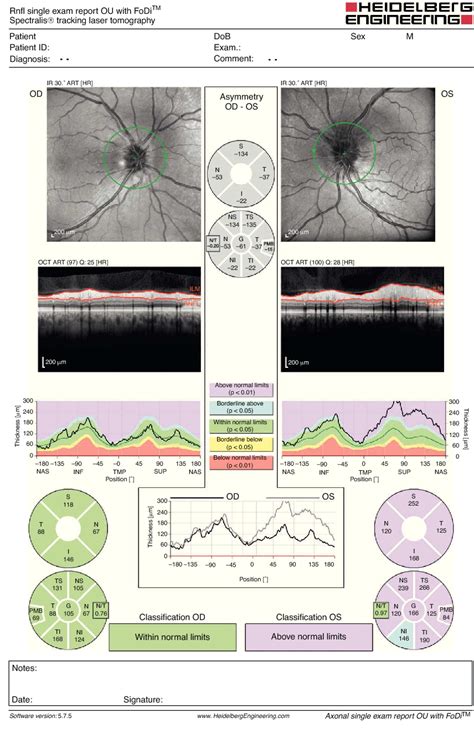 Figure 2 From Non Arteritic Anterior Ischemic Optic Neuropathy As First