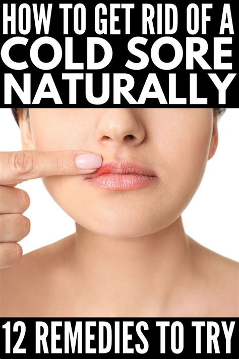Fast And Effective 12 Natural Cold Sore Remedies That Work Natural