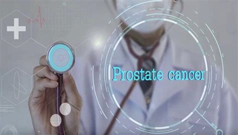 Prostate Cancer What You Need To Know Faculty Of Health Sciences