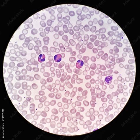 Human Blood Smear Under 100x Light Microscope With Eosinophils