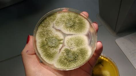 Aspergillus Fumigatus Sabouraud Agar Plate Microbiology Fungi