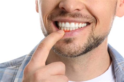 Tips On How To Avoid Receding Gums Parkview Dentistry Of Az