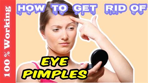 How To Get Rid Of Pimples On Eyelids Overnight Fast Home Remedies