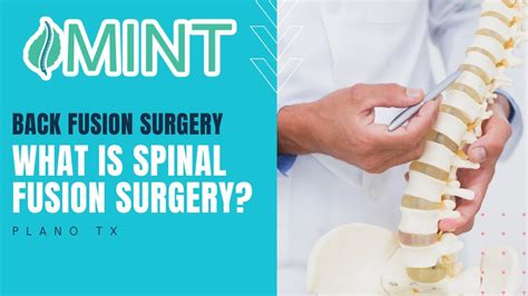 Back Fusion Surgery In Plano Tx What Is Spinal Fusion Surgery Dr