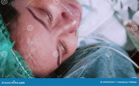 Close Up Face Patient Intubated Lying On Operating Table In Operating