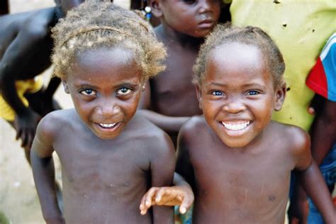 Kwashiorkor Saat Rambut Anak Berubah Kekuningan Akibat Kurang Gizi