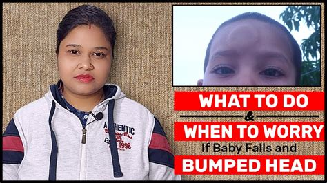 What To Do If Baby Fall And Bumped His Head When To Worry If Baby Has
