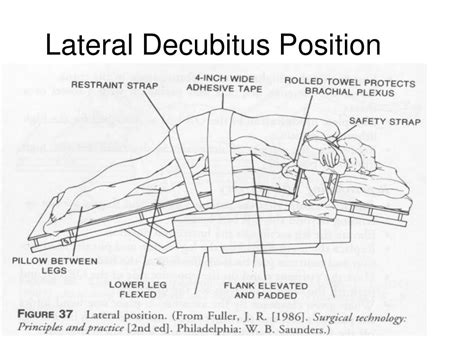 Right Vs Left Lateral Decubitus Position