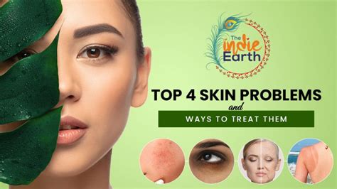 Top 4 Skin Problems And Ways To Treat Them The Indie Earth Canada